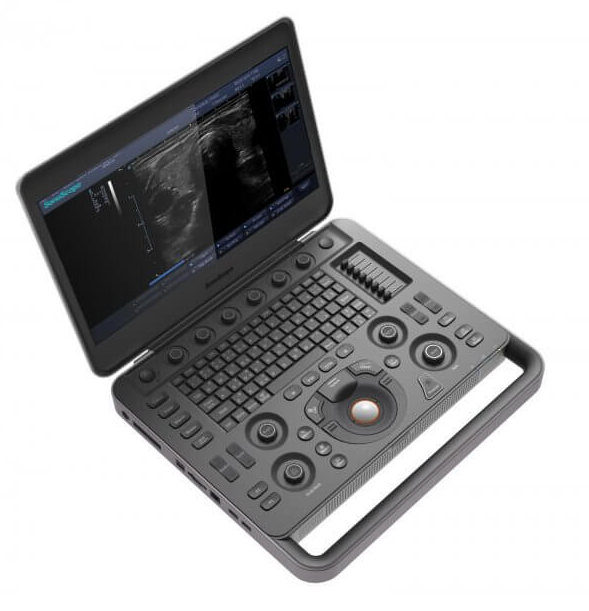 УЗИ: R-VQS (Radiofrequency Vascular Stiffness Quantification)